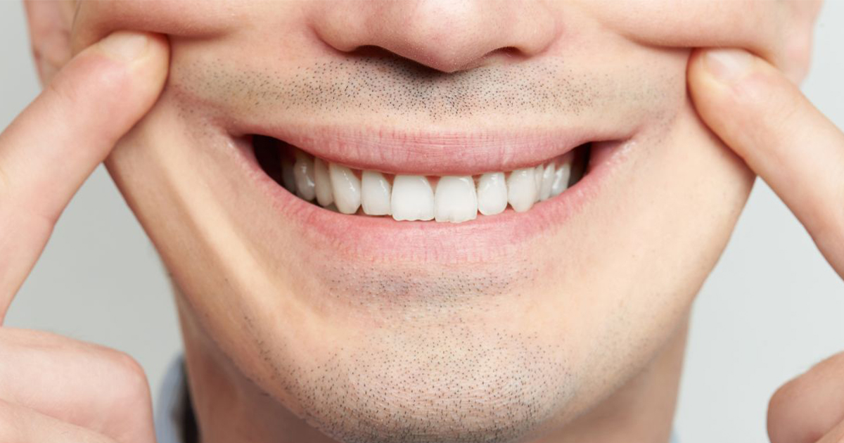 smile, the lack of movement in the outer part of the muscle that orbits the...